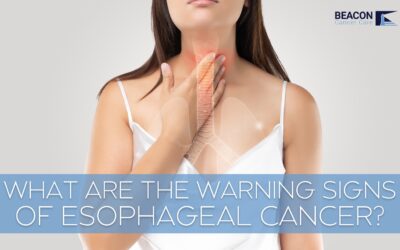 What Are the Early Warning Signs of Esophageal Cancer?