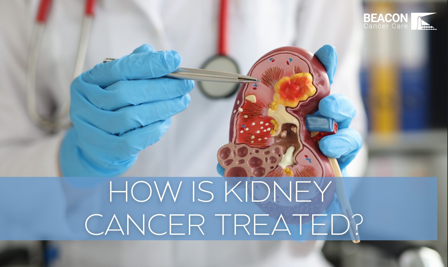 How is Kidney Cancer Treated? - Beacon Clinic