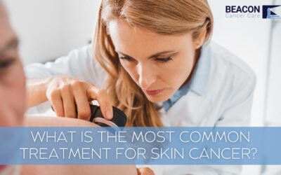 What Is the Most Common Treatment for Skin Cancer?