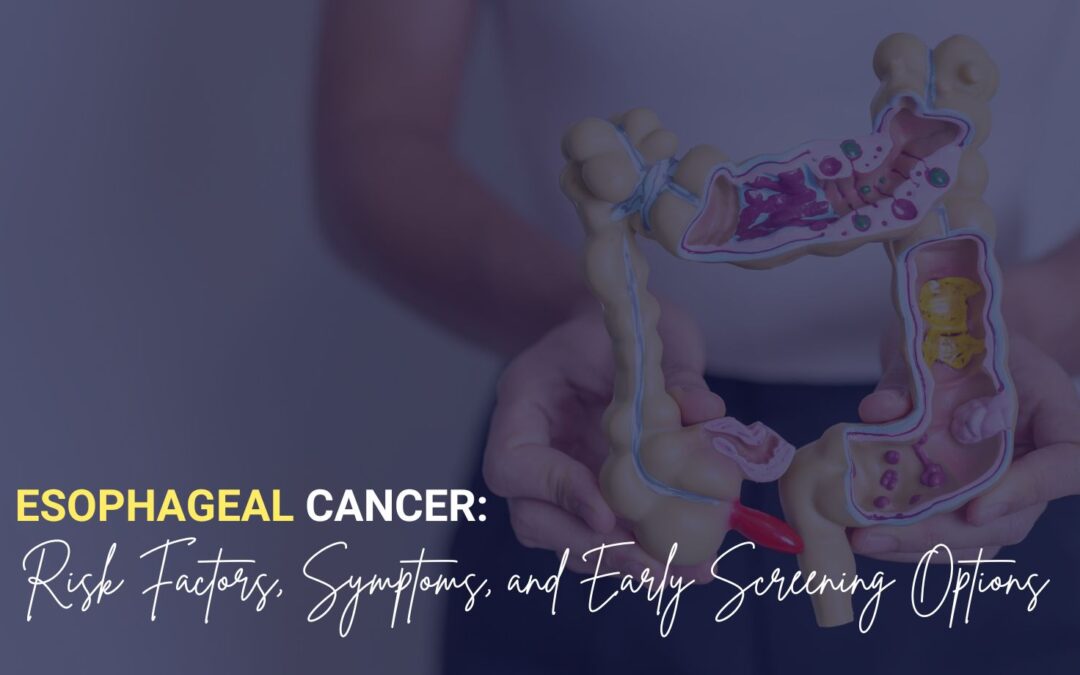 Esophageal Cancer- Risk Factors, Symptoms, and Early Screening Options
