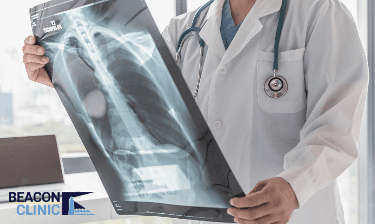 Bone Cancer: Recognizing Symptoms and Treatment Advances